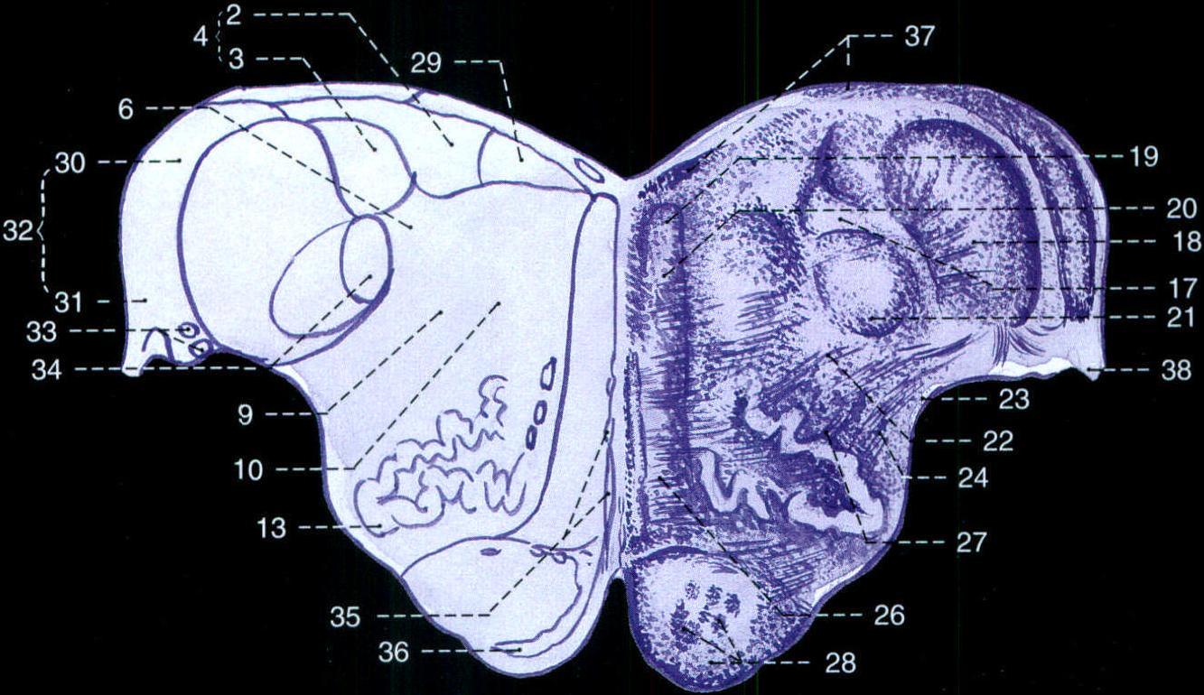 369.延髓水平切面(經橄欖上部)
